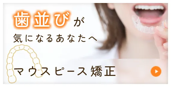 マウスピース矯正