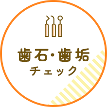 歯石・歯垢チェック