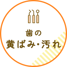歯の黄ばみ・汚れ