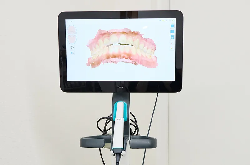 精密なスキャナー「IiTero Lumina」を導入